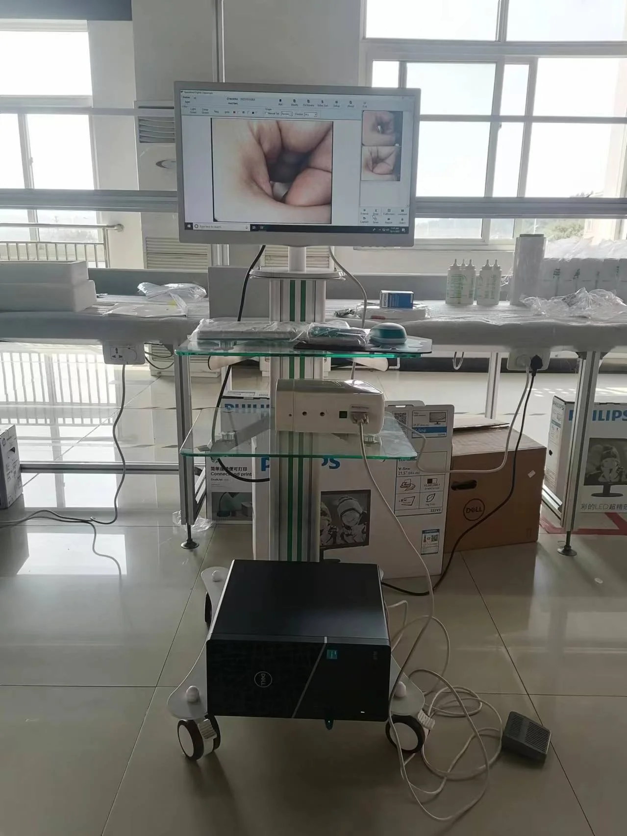 Medical specialized gynecological digital optical colposcopy with camera high-definition display
