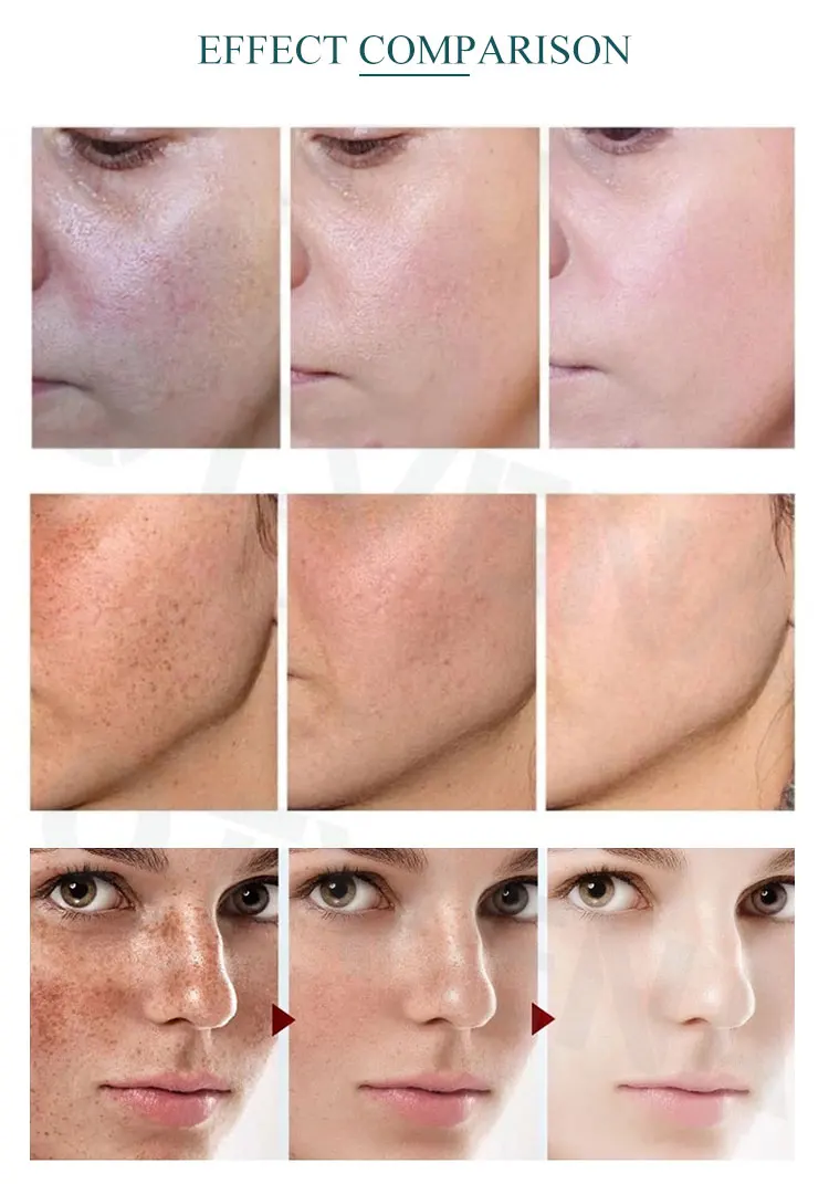 Copper peptide Retinol vitamin C E hyaluronic acid anti aging wrinkle Cream