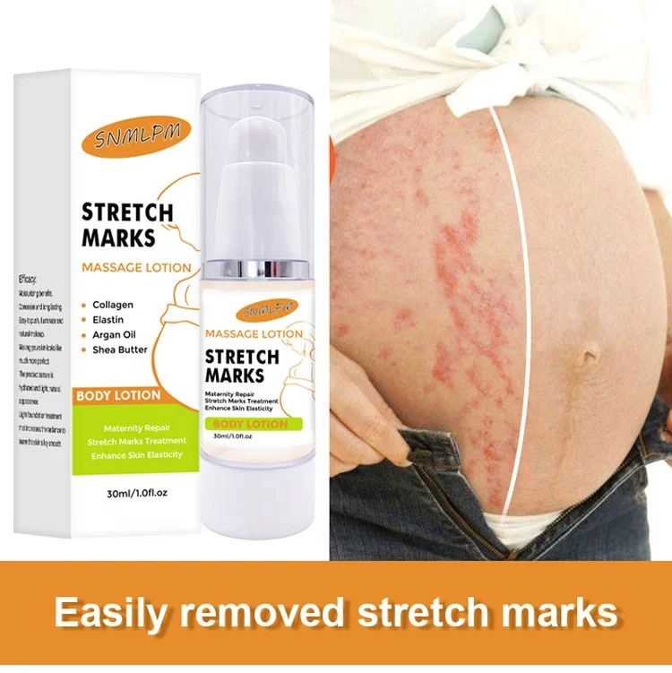 New Private Label Effective Original Organic Skin Repair Revitalizer Body Scar Remover Gel Pregnancy Stretch Mark Removal Cream
