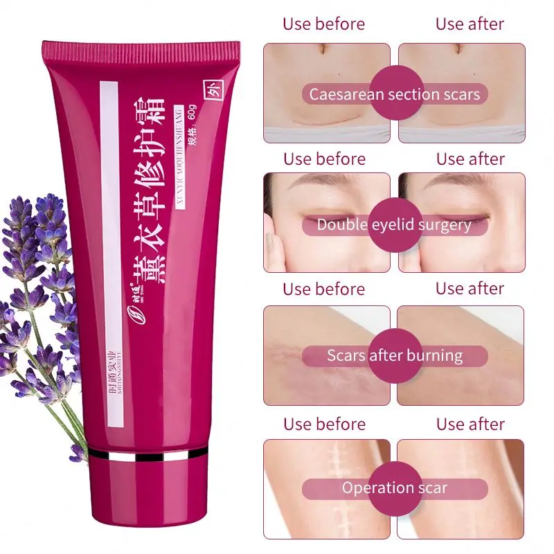 Wound treatment cream skin care women vitamin c cream for face anti wrinkle face cream