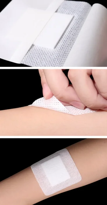Adhesive Absorbent Wound Dressing For High Exduates Wound 10*25 Nonwoven Wound Dressing