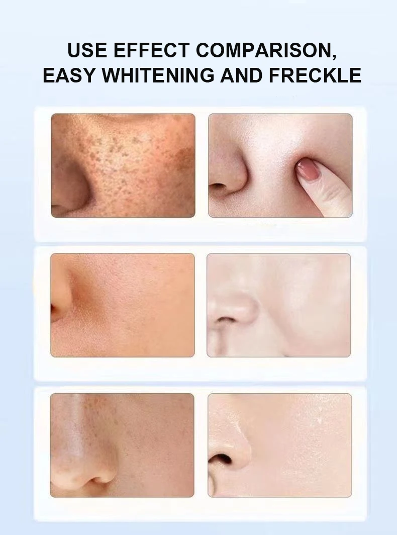 private label skin care cream niacinamide trehalose moisturizing brightening light spot repair skin cream
