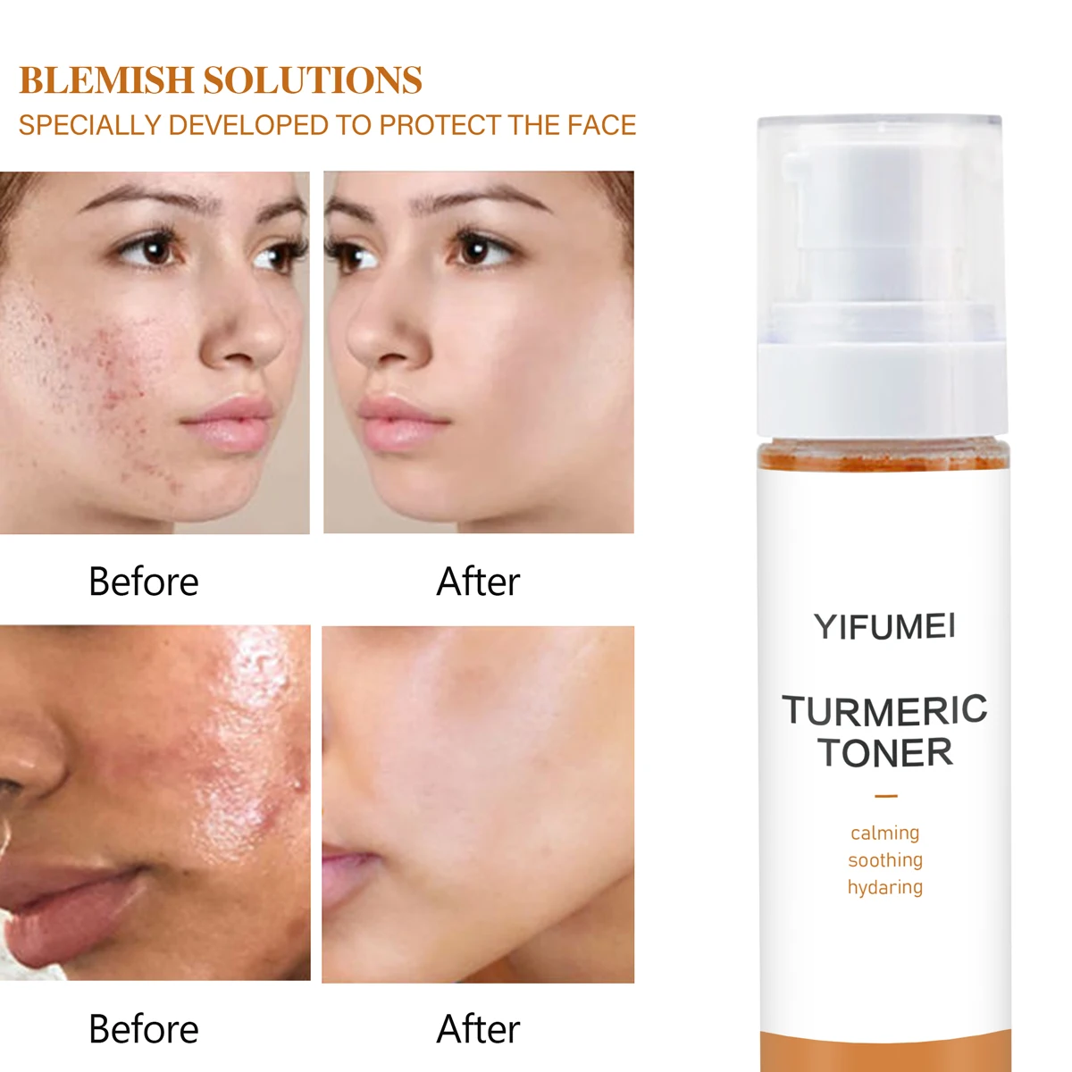 Hot Selling Natural Vitamin C Refershing Moisturizing Acne Mint Turmeric Whitening Facial Toner For Face