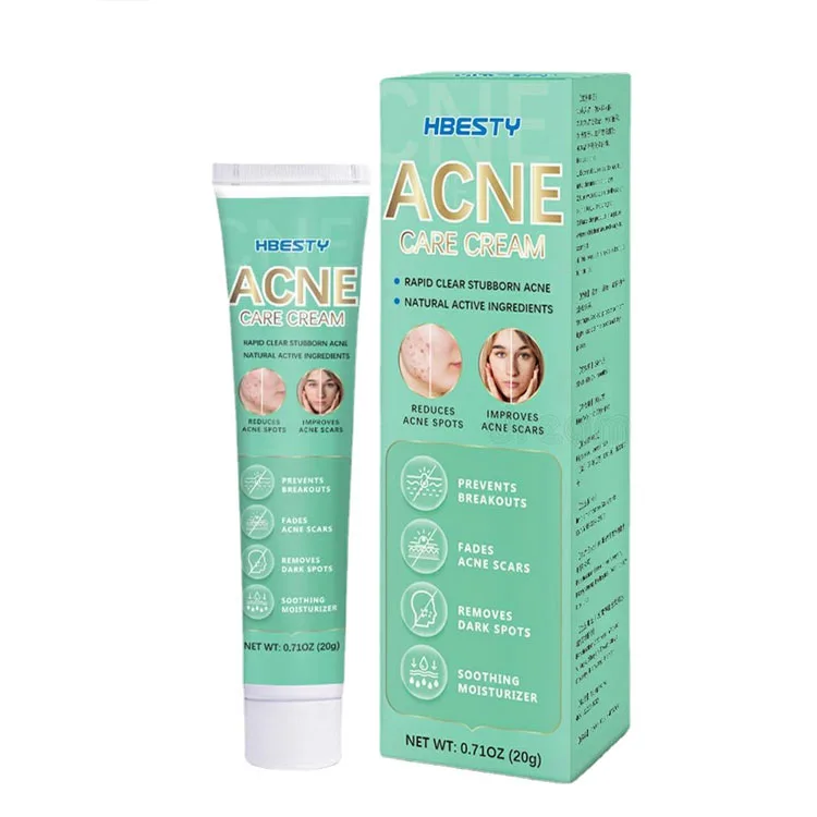Hot Selling Skin external use cream Anti acne Repair acne marks Brighten skin HBESTY Acne Care Cream 20g