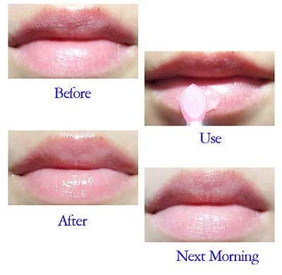 Private Label Cruelty Free Vegan Soft Collagen Whitening Bleaching Treatment Pink Lip Lightening Cream For Dark Lips