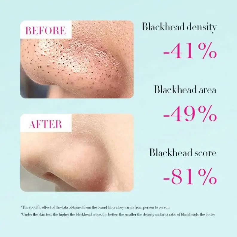 Mask Skin Care Products Beauty Hydrating Deep Cleaning Remove Blackheads Anti Acne Nose Patch Double Head Lipstick