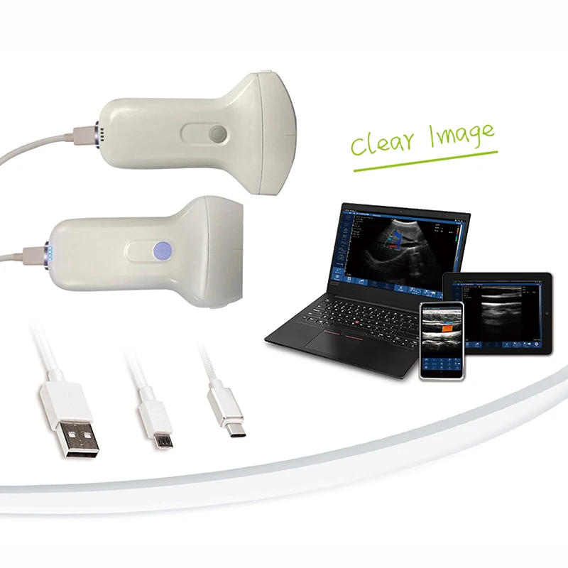 2021 Новый USB + WIFI Портативный беспроводной выпуклый/линейный ультразвуковой зонд цветной Доплер для