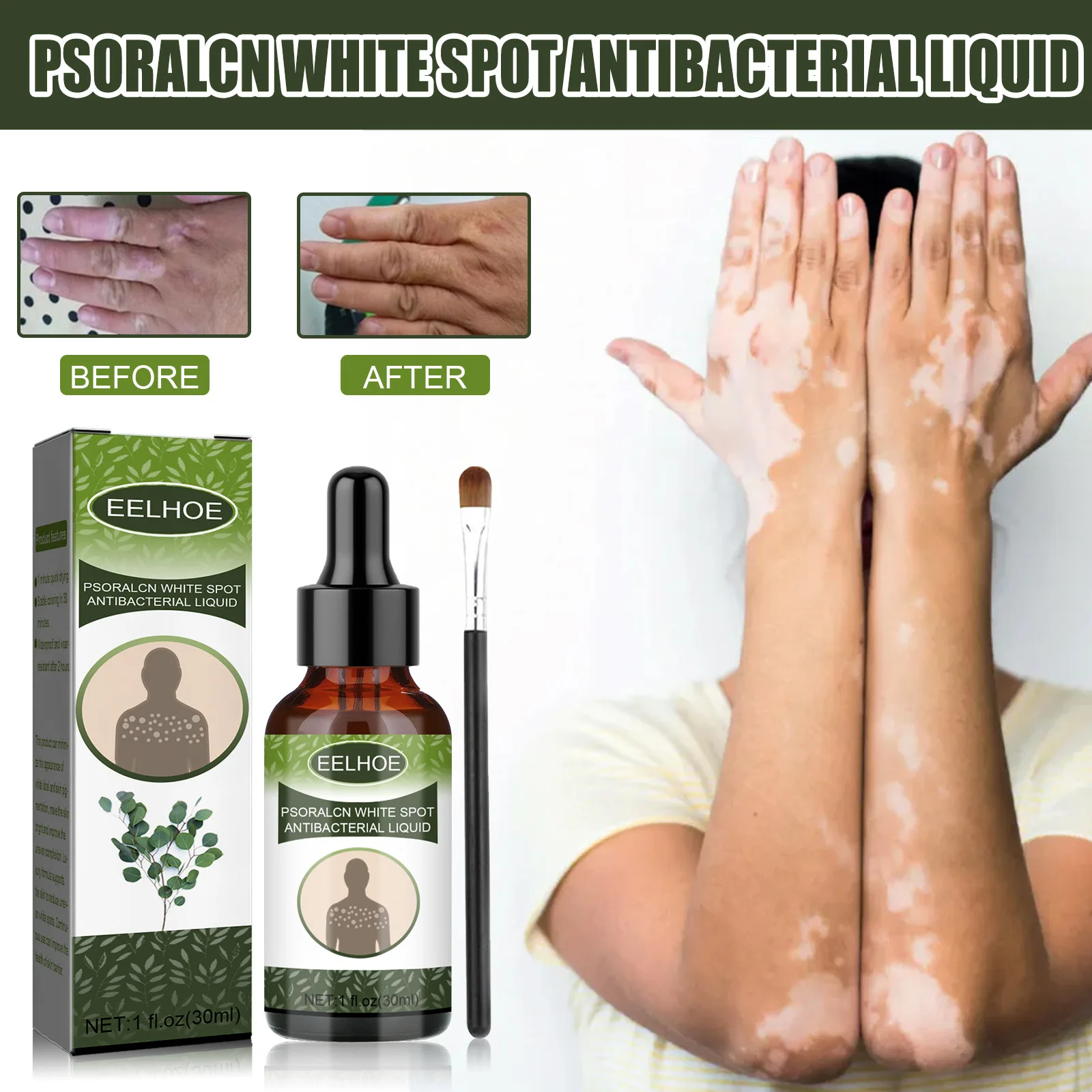 Popular plant extract EELHOE white spot removal anti bacterial liquid repair flecks sweat spots skin moisturizer care serum