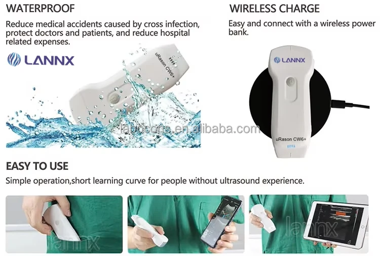 LANNX uRason CW6+ New 128 elements 3 in 1 USG Wireless Ultrasound Probe Thyroid Pregnancy Cardiac Color Doppler Probe Ultrasound