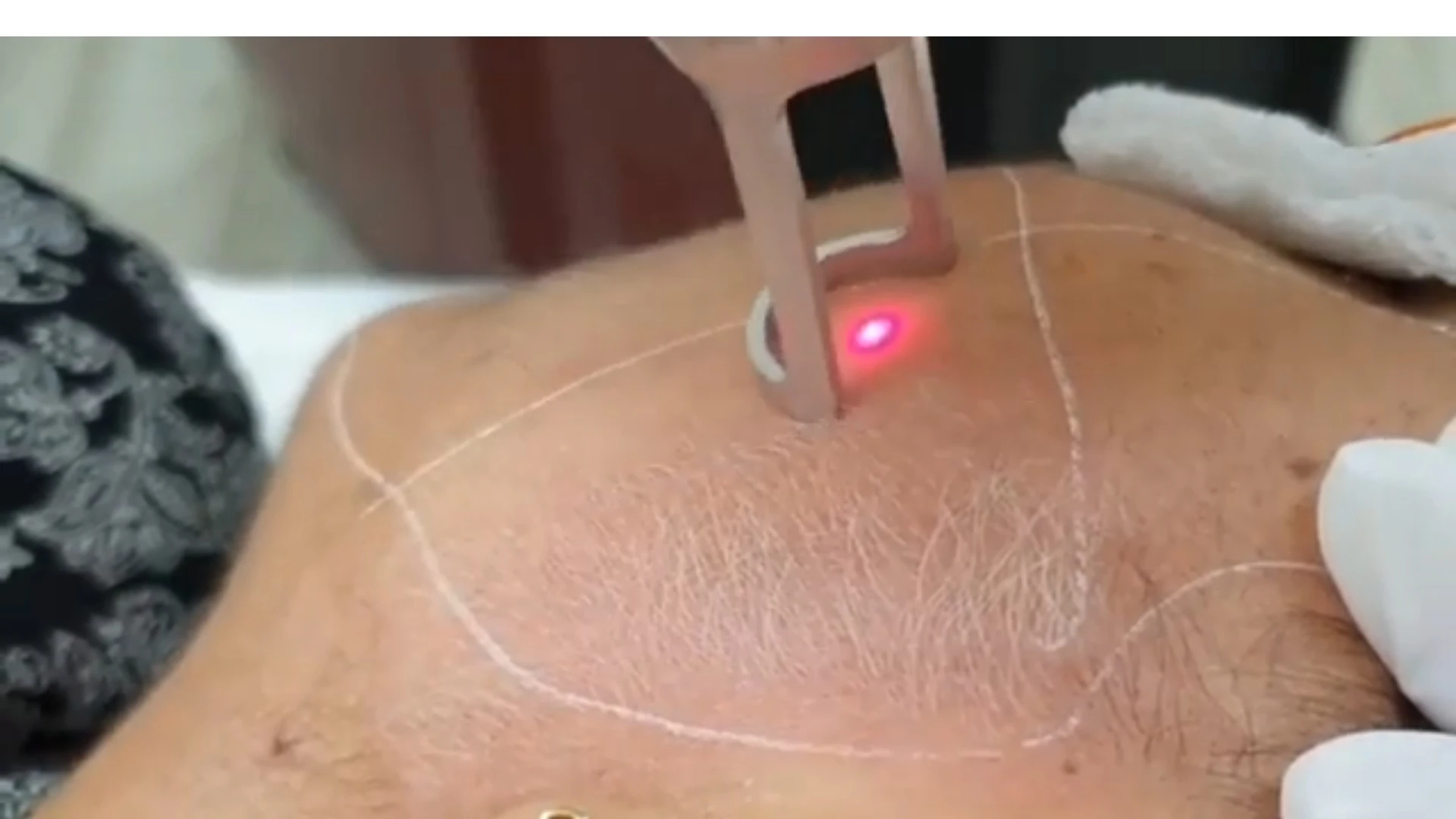 
2021 hair bleach laser beauty machine 