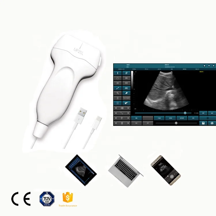 
GYGN-CE/ISO medical USB UP20L linear USB portable/handheld ultrasound machine for PICC/ICU 