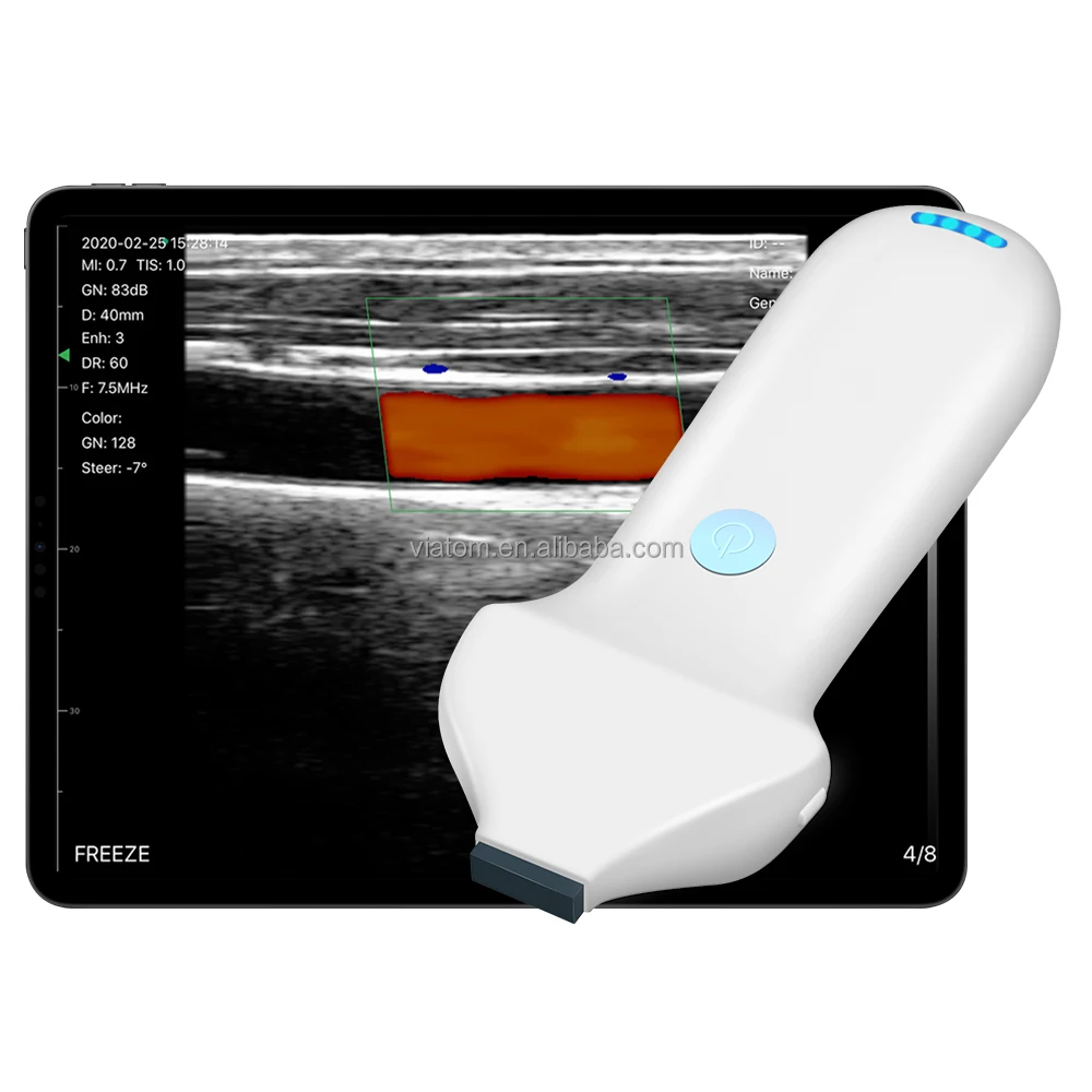 Viatom 192 Elements Handheld Ultrasound Beauty Injections High Frequency Linear Portable 18/24Mhz Wireless Ultrasound Probes