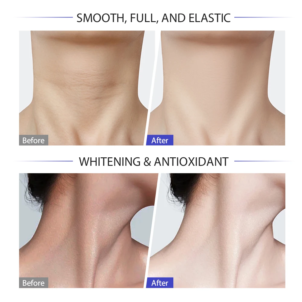 MOIKA High Quality Neck Firming Cream of Moisturizing Anti Wrinkle Firming Private Label Neck Cream OEM ODM Neck Cream