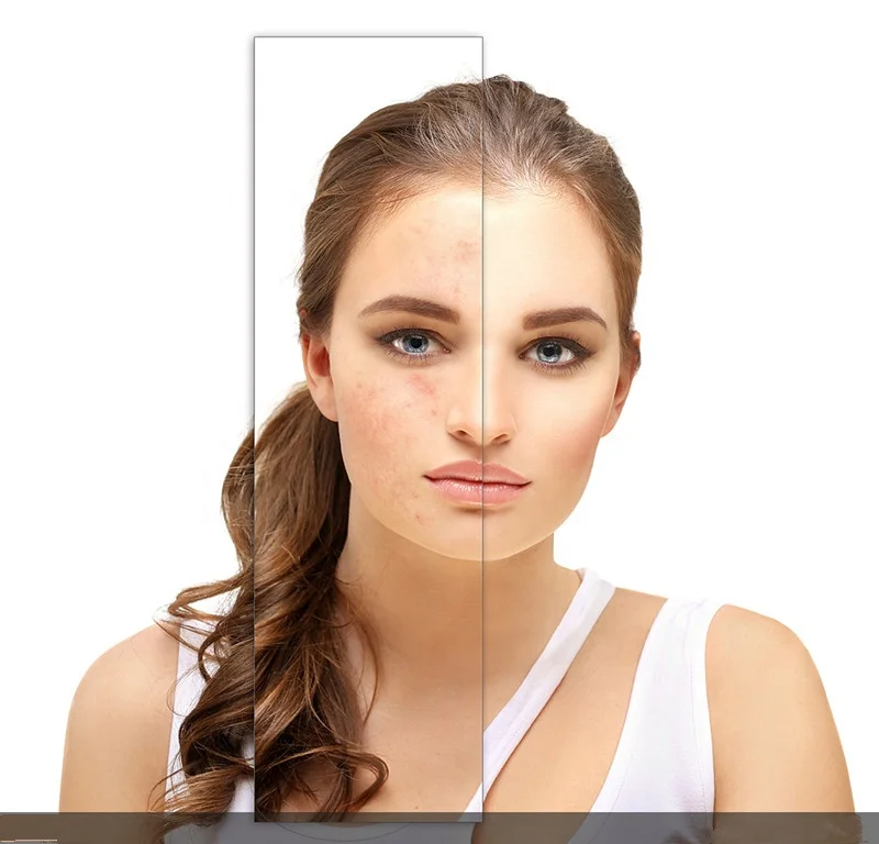 
Best peptide bfgf white powder for anti-wrinkle 