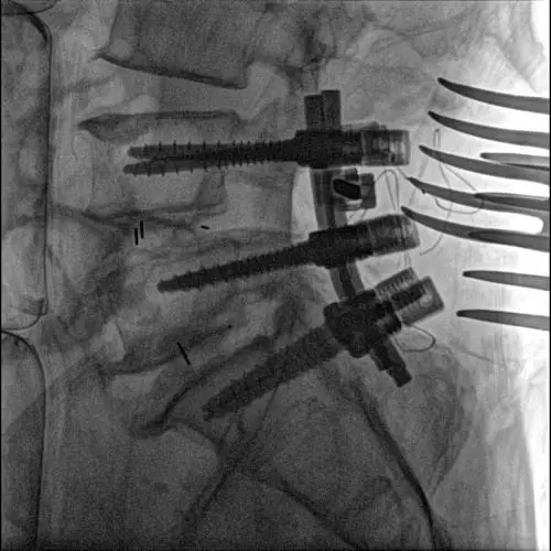 Colored Navigation Mobile C arm x ray system