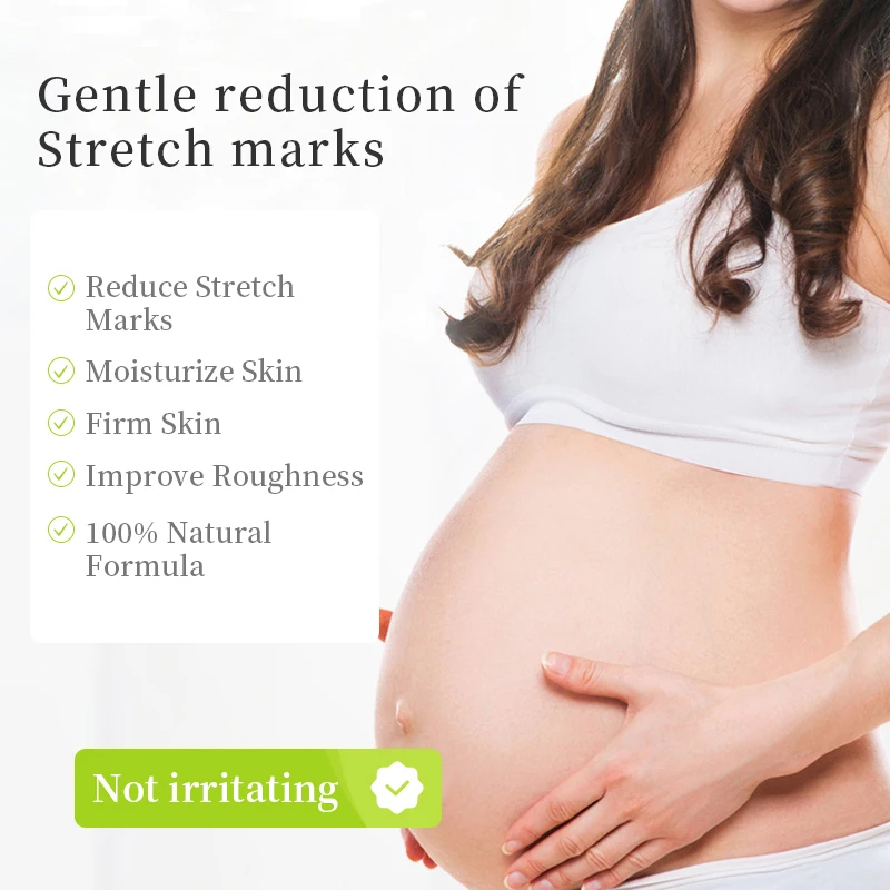 Stretchmark Remover Cream Natural Organic Body Scar Pregnancy Repair Body Anti Scar Removal Stretch Mark Cream