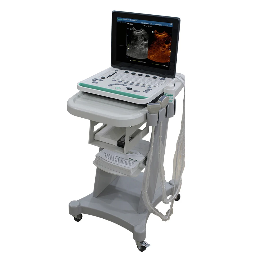
SS-9 Portable Laptop Color Doppler Ultrasound Machine Scanner Convex Linear Transvaginal Probe 