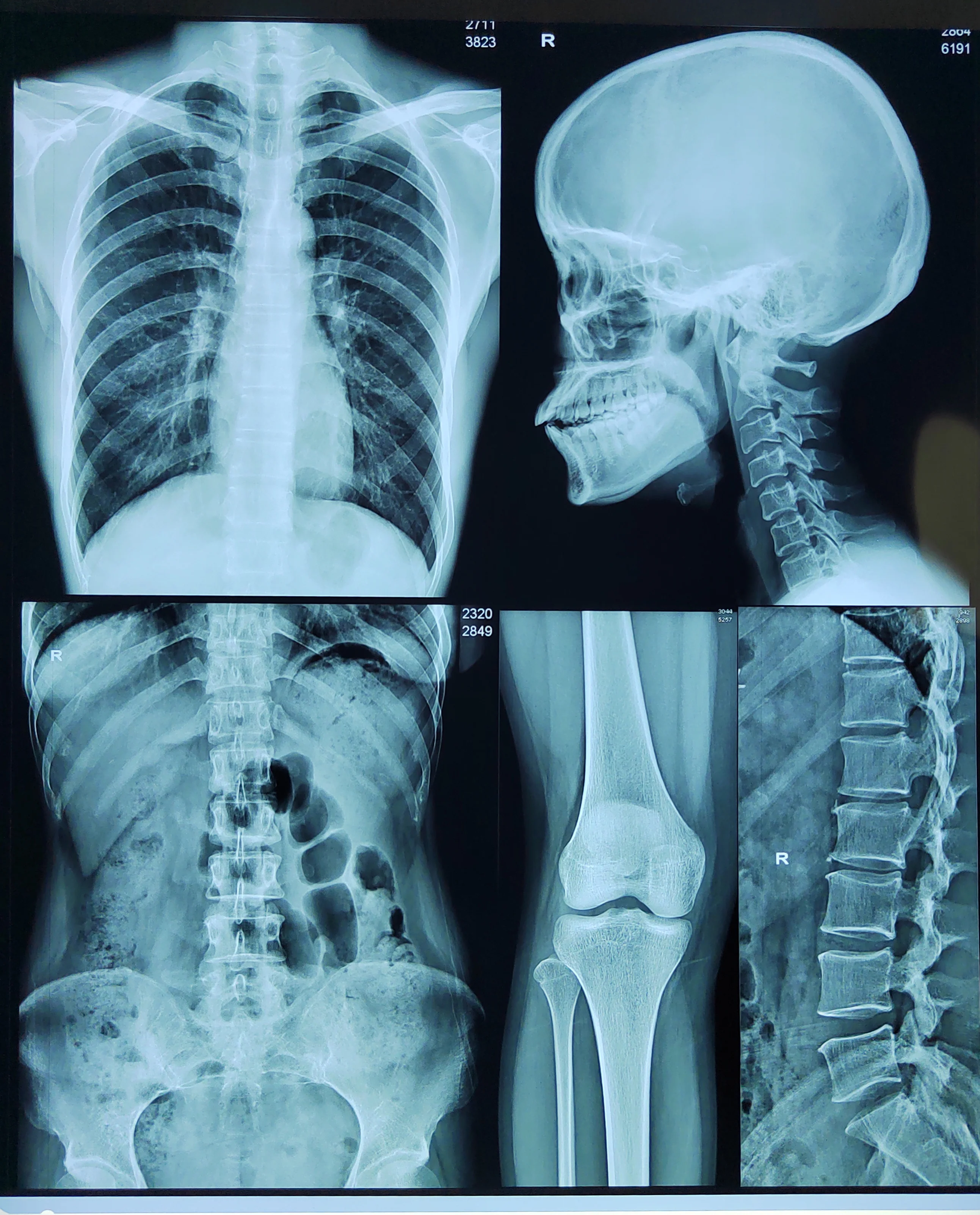 hot sale 8*10, 14*17 inch X Ray Image Film thermal x ray dry film for Agfa 5302