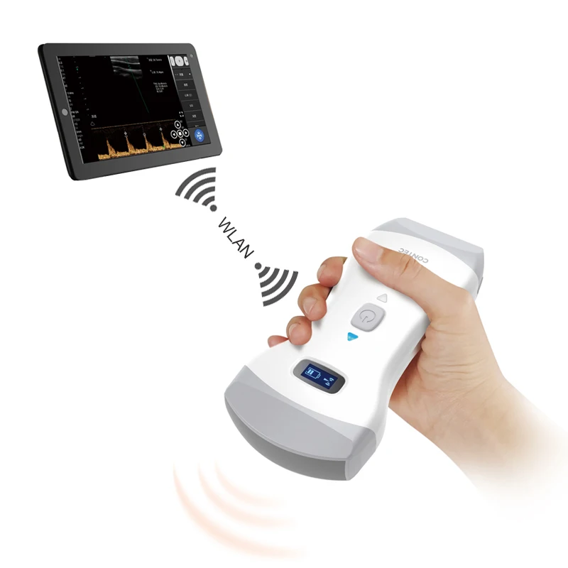 CONTEC CMS1600B Mobile Doppler Ultrasound Scanner