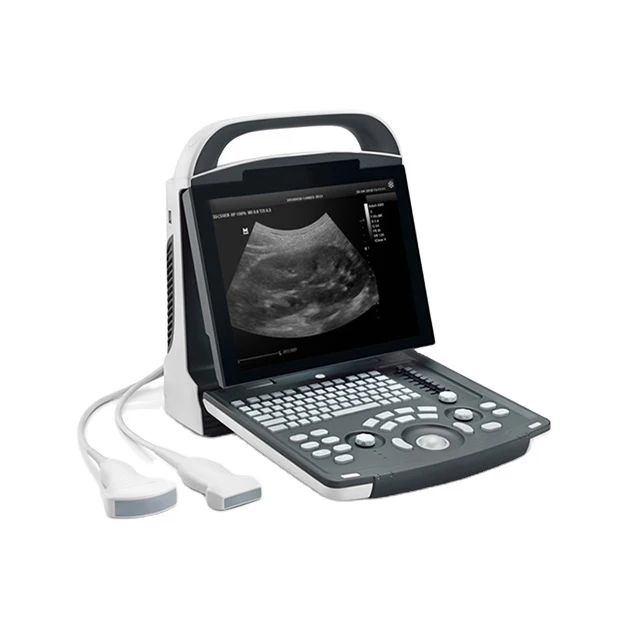 Mindray Dp-10 портативный ультразвуковой сканер машина цифровой B/w Mindray ультразвуковая система
