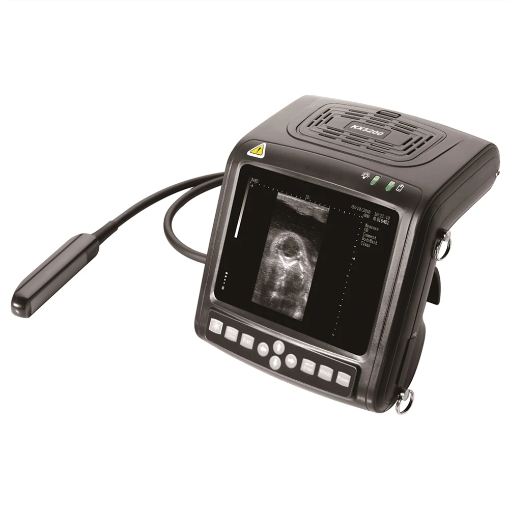 Ультразвуковой диагностический сканер KX5200, 5,7 дюймов