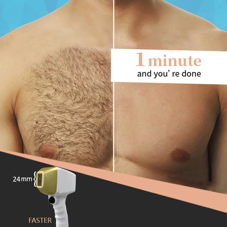 Professional portable 808 diode laser machine mini diodo laser 808nm 755 808 1064 diode laser hair removal machine