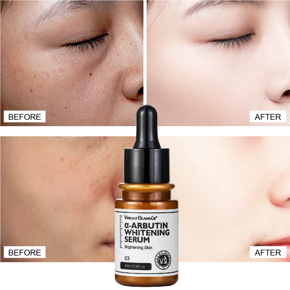 VIBRANT GLAMOUR Arbutin Skin Whitening Brightening Serum Dark Spot Removal Face Serum