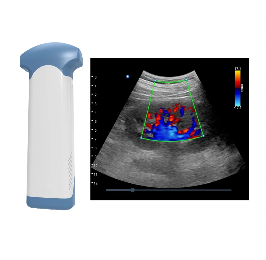 Color Doppler Probe Ultrasound Scanner Portable Wireless Wifi For IOS Android