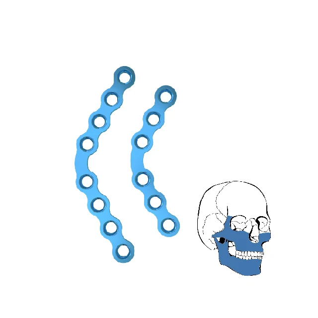 Orthopedic implant 120 degree Arc Plate maxillofacial surgery