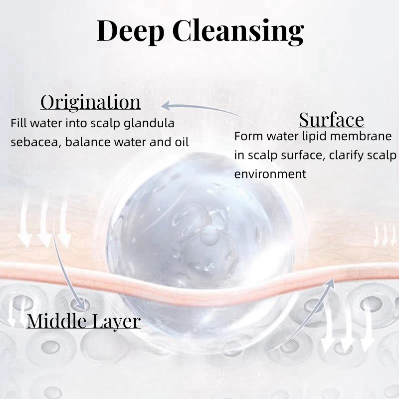 Sulfate Free Oily Scalp Anti Dandruff Shampoo Private Label Bio Plant Gentle Clean Shampoo