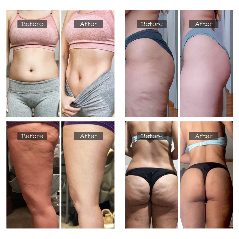 Аппарат для похудения электрический