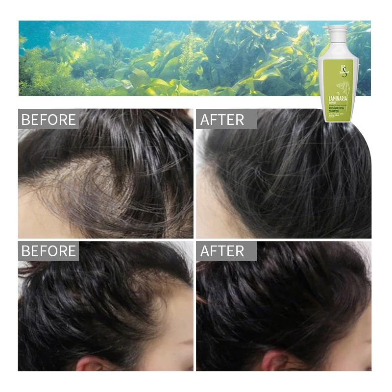 Wholesale 100 Moq Natural Organic Seaweed Hair Shampoo And Conditioner For Moisturizing Oil Control