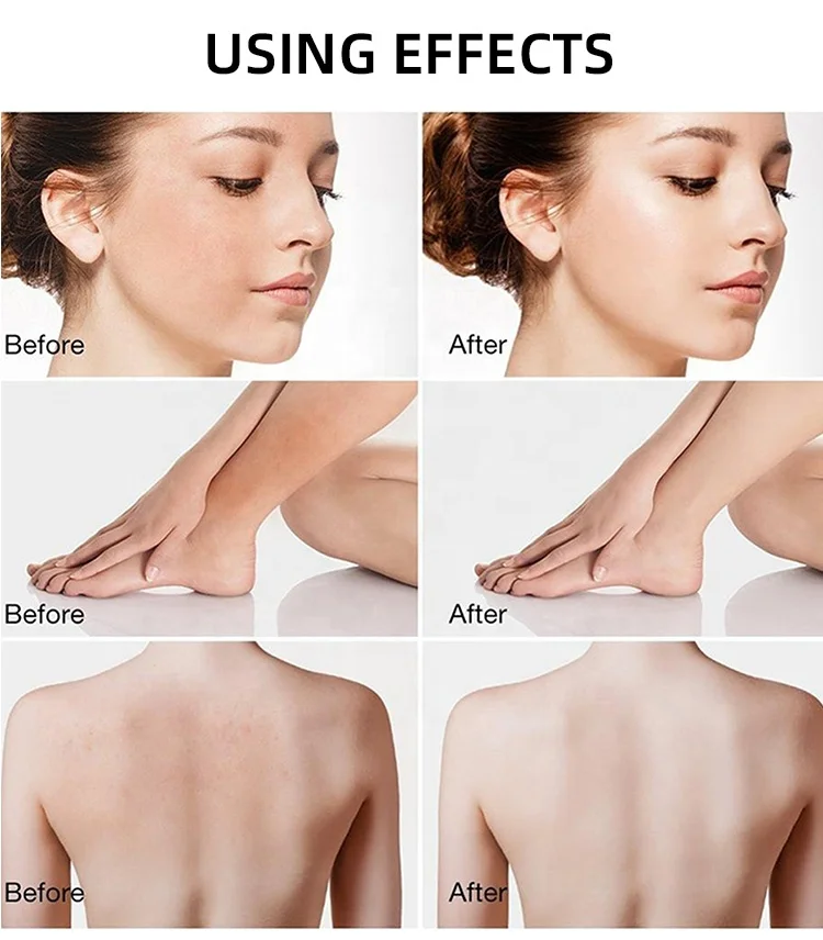 private label deep cleansing face scrub skin whitening exfoliating organic coffee body scrub