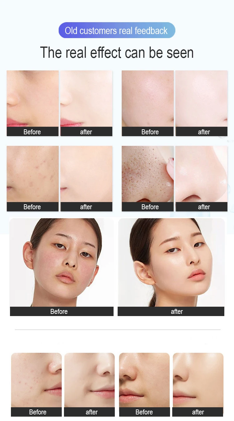 2025 Top Selling oxygen making machine portable oxygene machine hydro diamond microdermabrasion facial equipment Discount