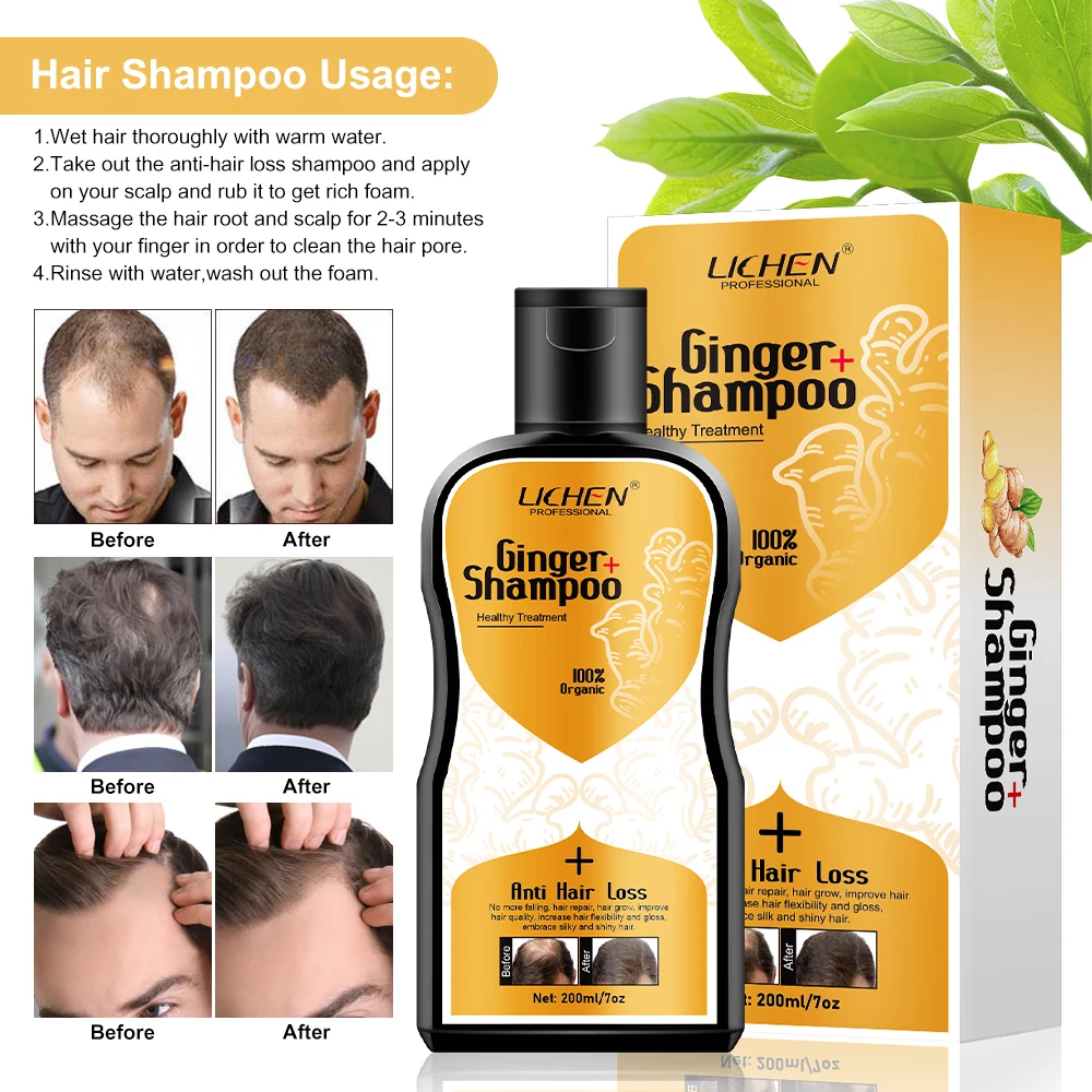 100% herbal plant ginseng anti-dandruff shampoo hair falling ginger shampoo hair loss