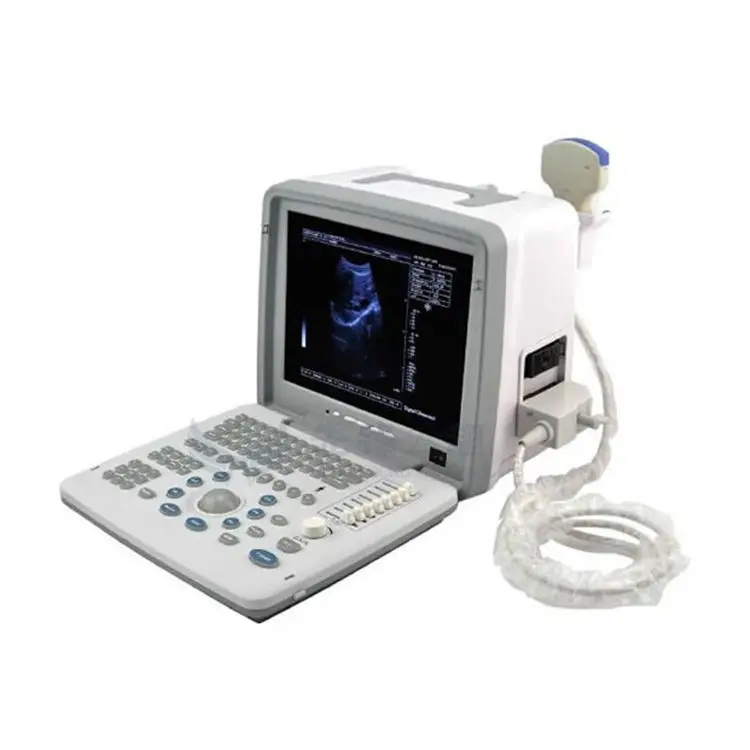 cheap medical B&w b ultrasound machine price with 3mhz probe
