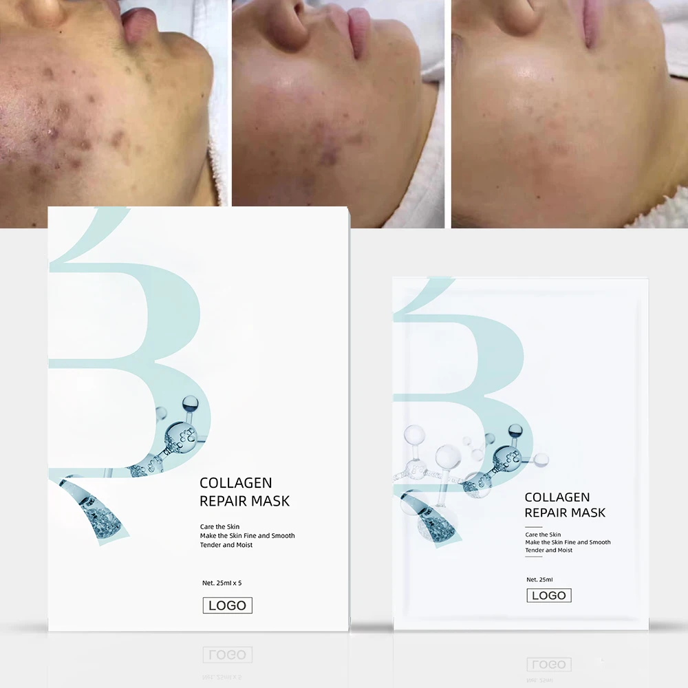 Laser Postoperative Repair Recombinant Humanized Type III Collagen Sheet Mask Deep Collagen Anti-wrinkle Lifting Mask