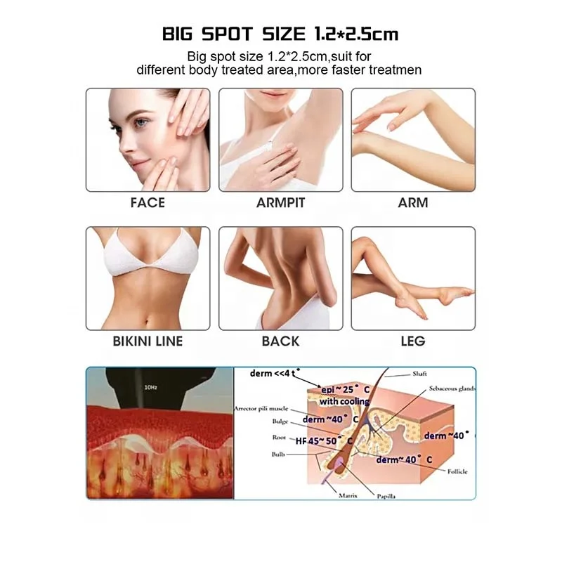 OEM ODM Ice Titanium Diode Permanent Pain Free Hair Removal 755 808 1064nm Diode Skin Rejuvenation Hair Removal Machine