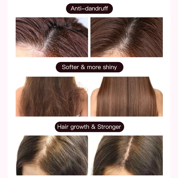 Sulfate free private label organic aloe vera rice hair care sets growth argan oil hair treatment mask shampoo and conditioner