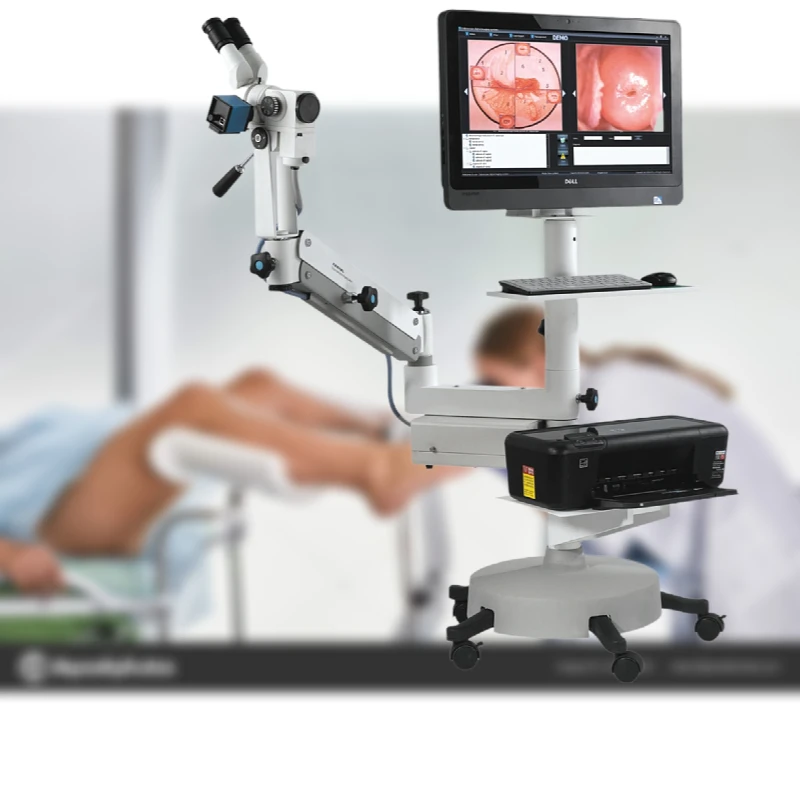 Kernel KN-2200BII Optical Vaginal Colposcopy Machine Medical Device Gynaecology Video Optical Colposcope for Gynecology