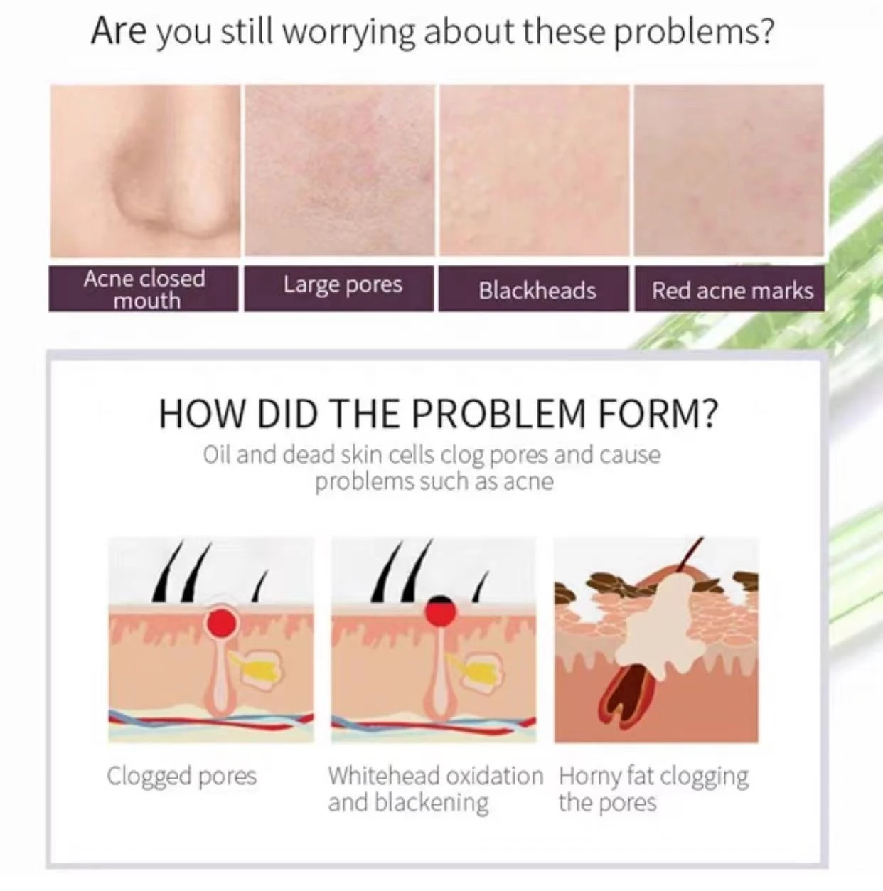 Hot sell Private Label Whitening Skin Care Exfoliating Remove Acne Scars Facial Serum Glycolic AHA 30% BHA 2% Peeling Solution