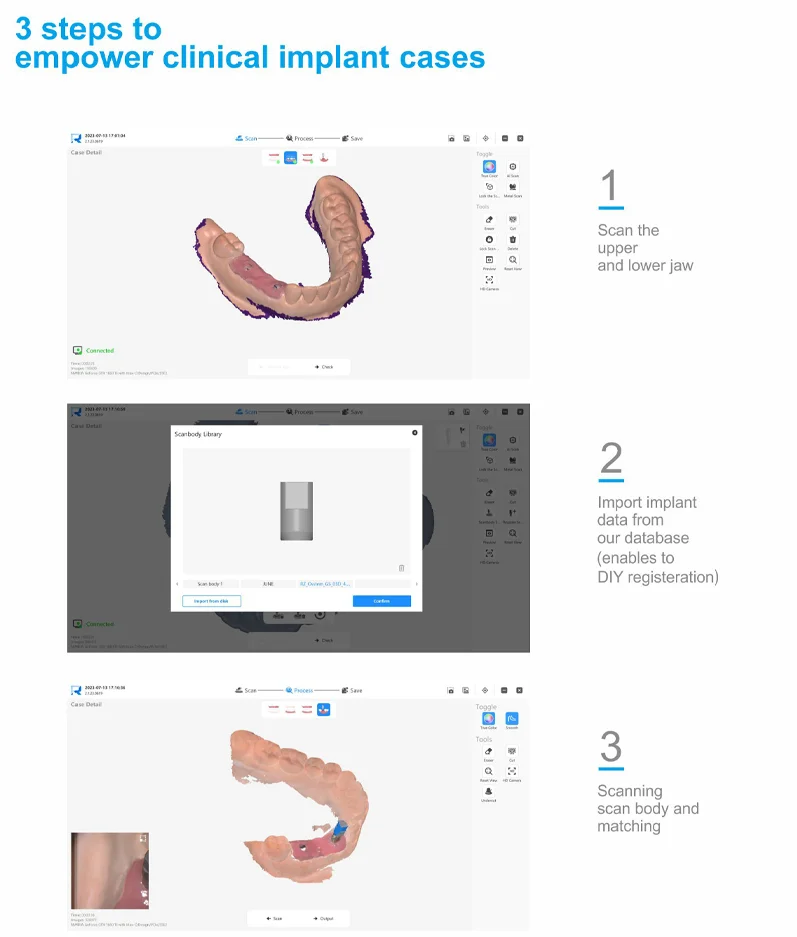 Medical equipment Runyes intraoral 3D scanner / Digital imaging system radiography scanner for impression implant orthodontics