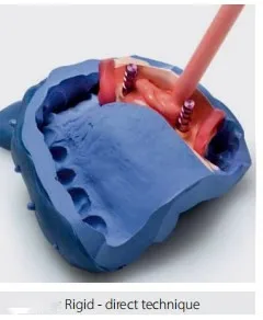 Making Dentures Material Non-reversible Duplication Gingival Dental Silicone Putty Dental Impression Kit for Gingival Mask