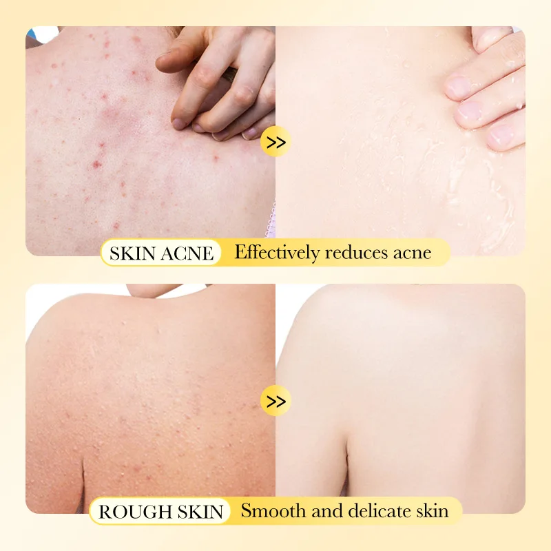 Manufacturer Wholesale Organic Natural Handmade Face Body Bathing Anti Acne Removal Salicylic Acid Exfoliating Sulfur Soap