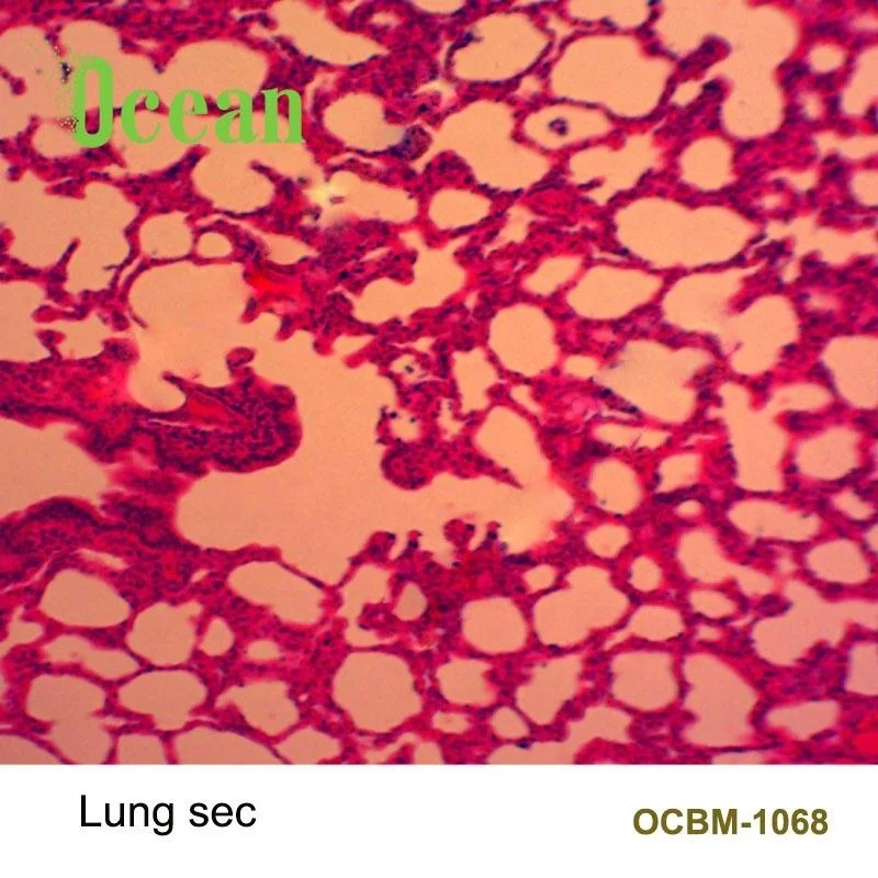 Lung sec. histology tissue microscope prepared slides