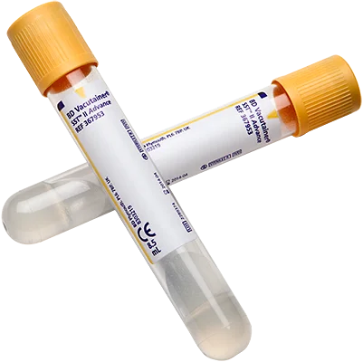 SST Serum Separation Tubes