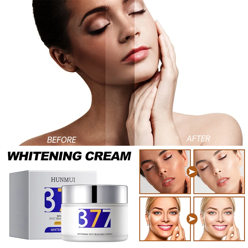 Private Label Freckle cream Nicotinamide Whitening Cream essence