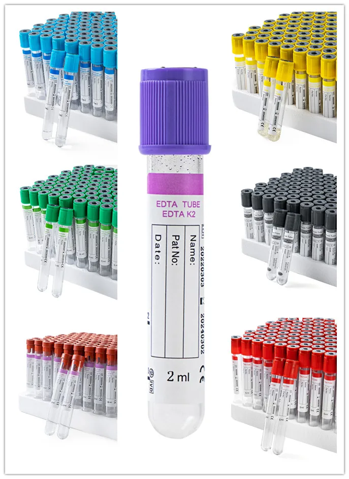 Одноразовая Медицинская вакуумная трубка гепарина крови (Литиевый гепарин)