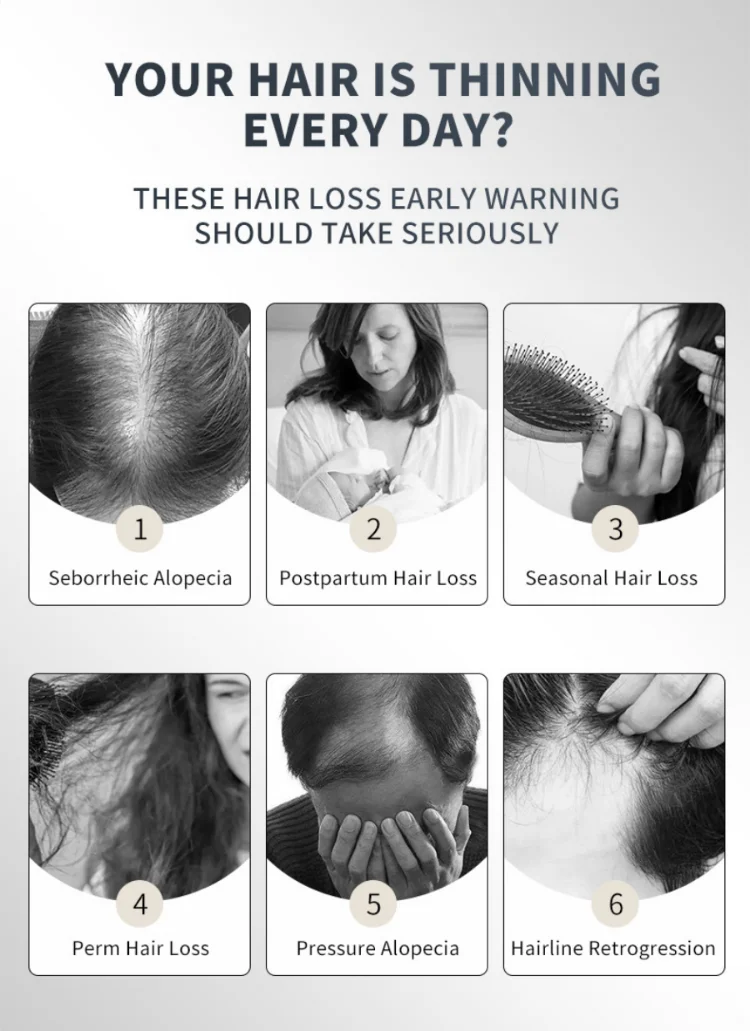 60ml Fast Hair Regrowth Serum Black Seed Castor Hair Growth Serum Oil Thick Hair Fast Growth For Black Women_13