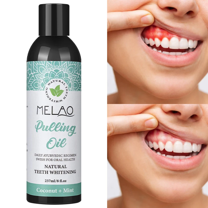 Private Label Coconut Oil Pulling Natural Vitamin E Alcohol Free Mouthwash Fresh Breath Teeth Whitening Gum Health Oral Care